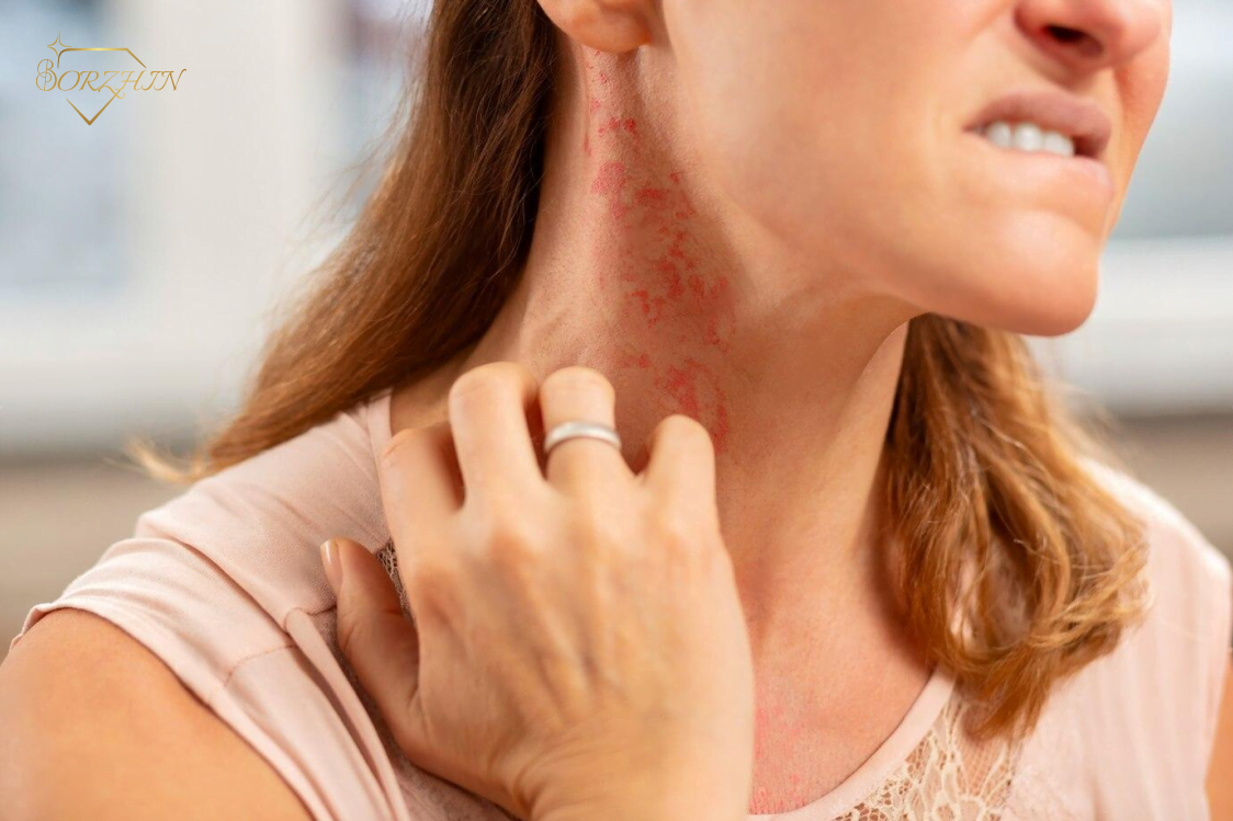 راههای جلوگیری از حساسیت به بدلیجات